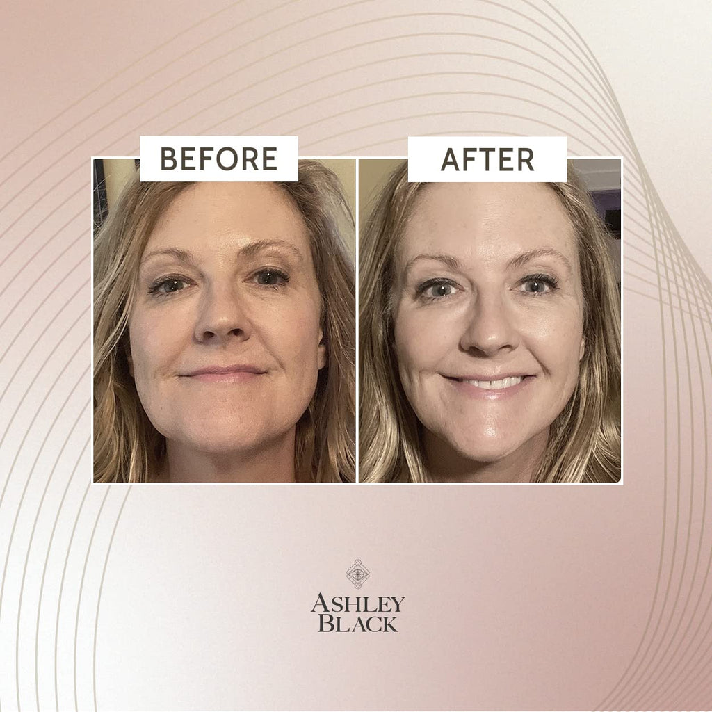 FasciaBlaster Extreme Tightening Serum by Ashley Black – Instant Tightening Up To 6 Hours, No Residue