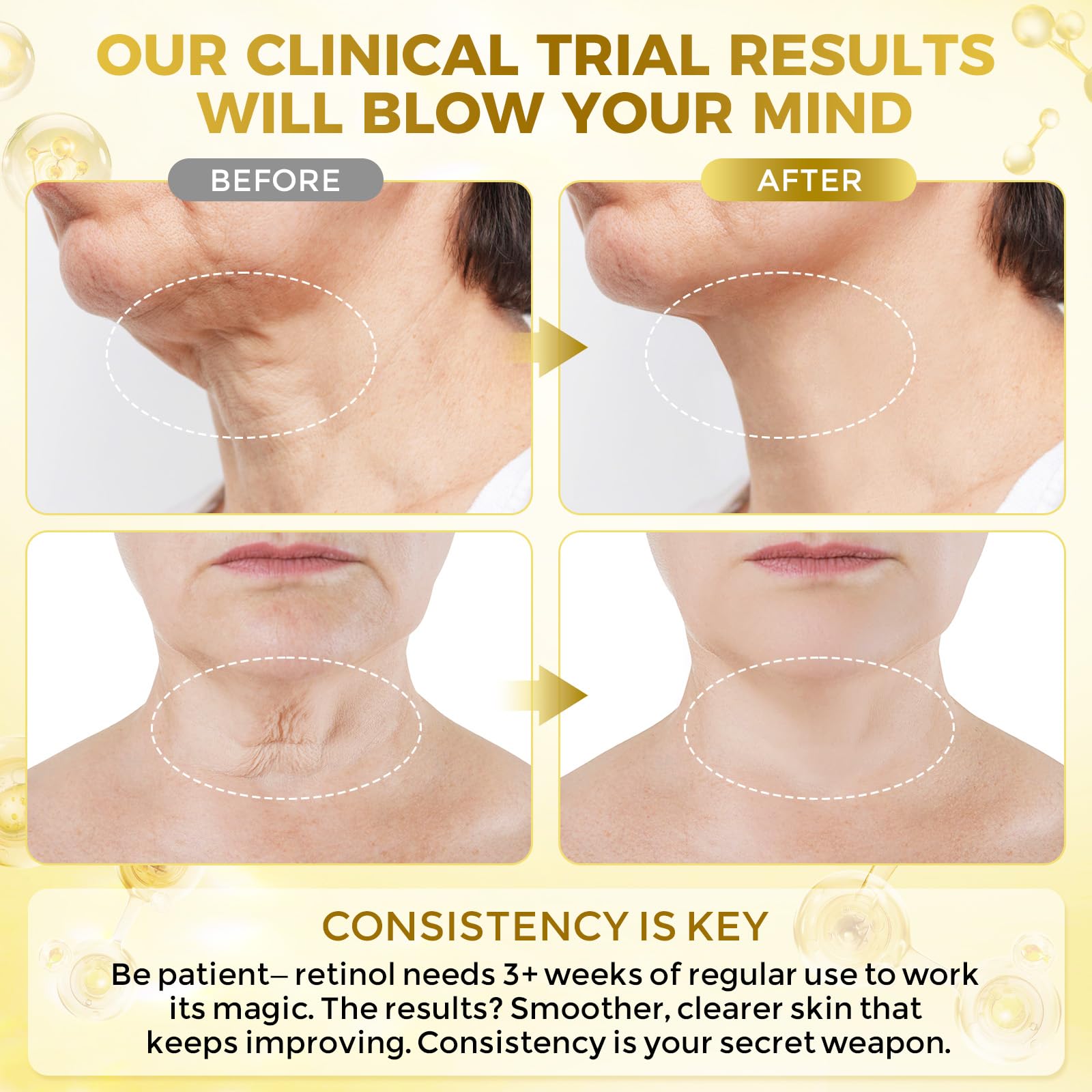 FeeMeFee Neck Firming Cream - Retinol, Peptides & Hyaluronic Acid
