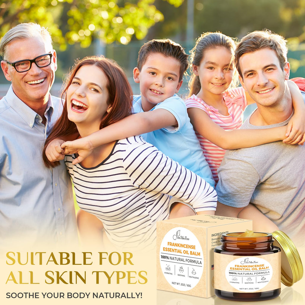 FeeMeFee Frankincense Balm 2oz – Soothing Moisturizer with Myrrh, Boswellia Serrata & Nutrient Oils