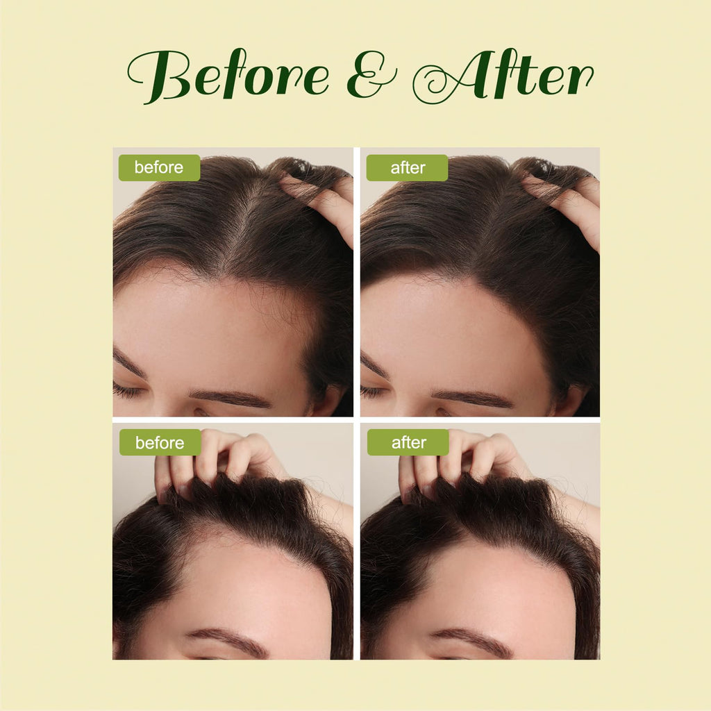 FEIBTH Natural Hair Growth Oil with Rosemary & Batana – 2 oz