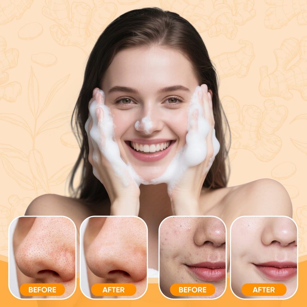 Femani Turmeric Face Wash Set – Turmeric Cleanser, Soap Bar & Oil for All Skin Types