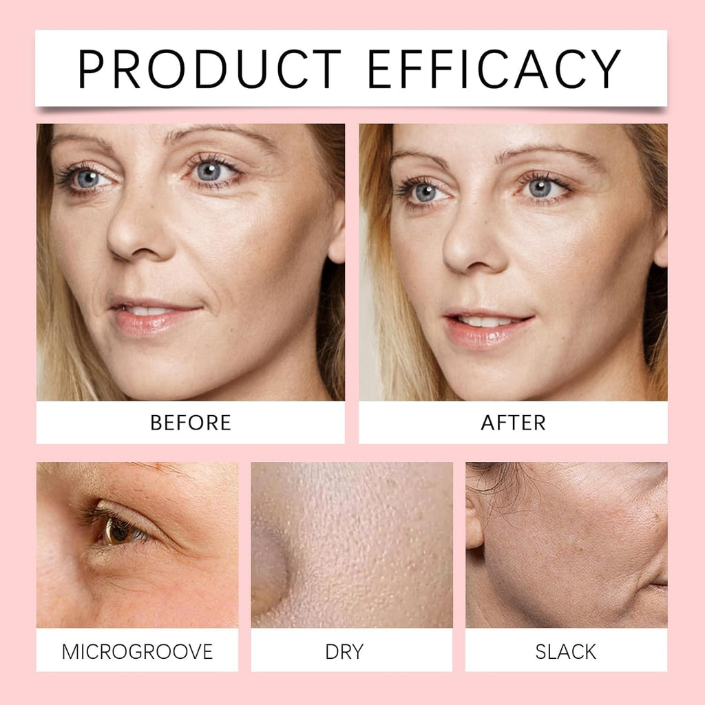 Finones Skin Vitamin Serum | 5-in-1 Anti-Wrinkle & Hydration for Face & Body