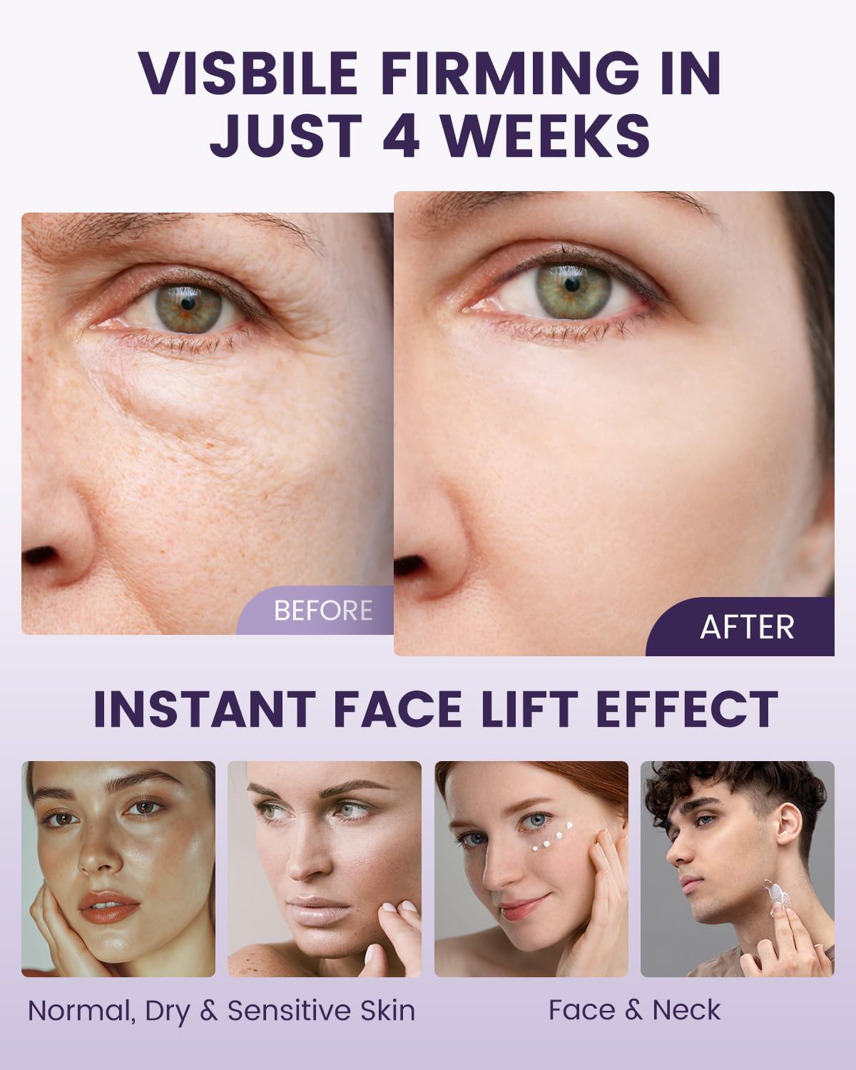 Fioraen Neck Firming Cream – 2% Retinol, 7% Hyaluronic Acid & 1% Collagen | AH-8 Lift for Neck & Décolleté