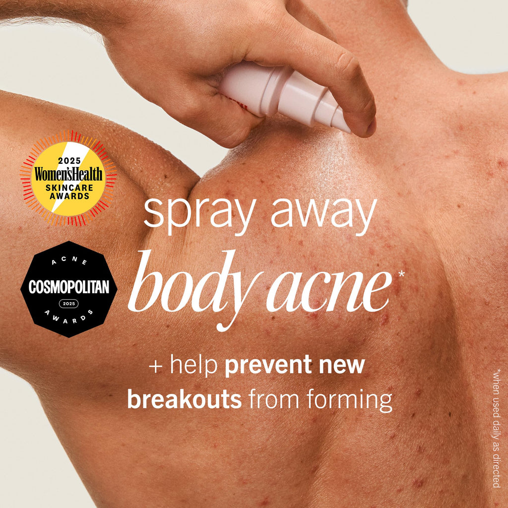 First Aid Beauty Body Acne Spray - Maximum Strength 2% Salicylic Acid, 360° Sprayer, 3 oz