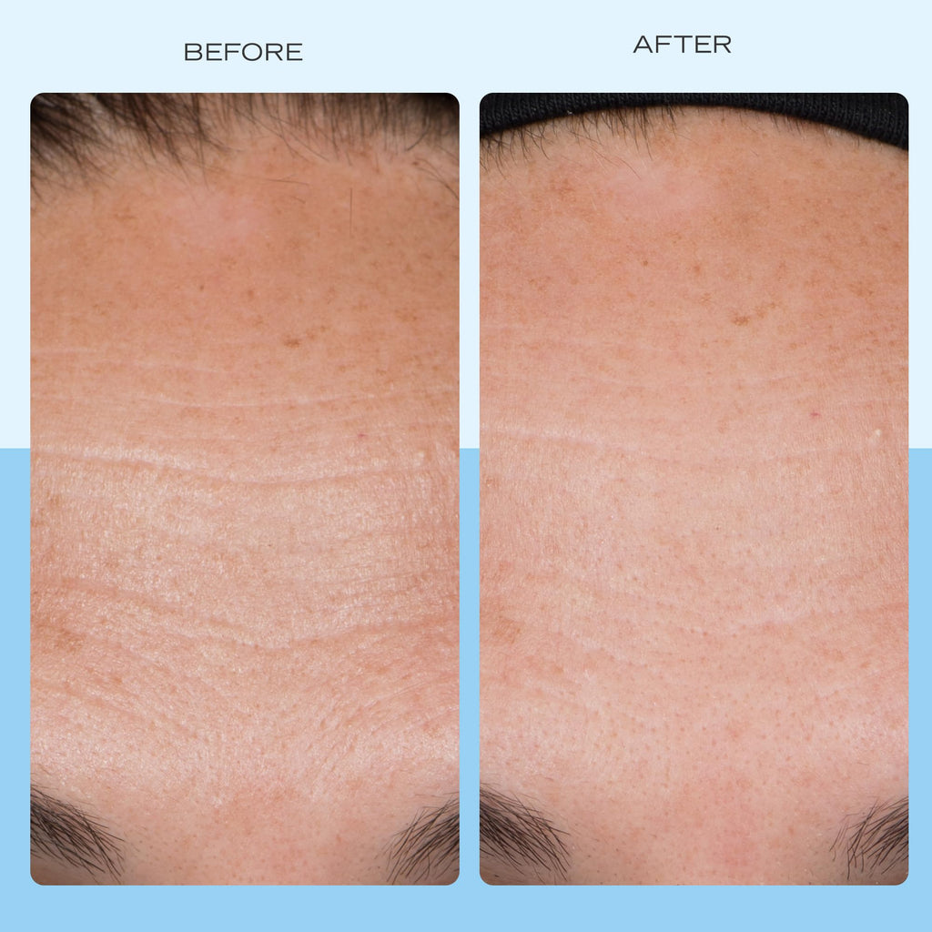 First Aid Beauty Firming Collagen Cream with Peptides & Niacinamide | Ultra-Rich, Non-Comedogenic Moisturizer
