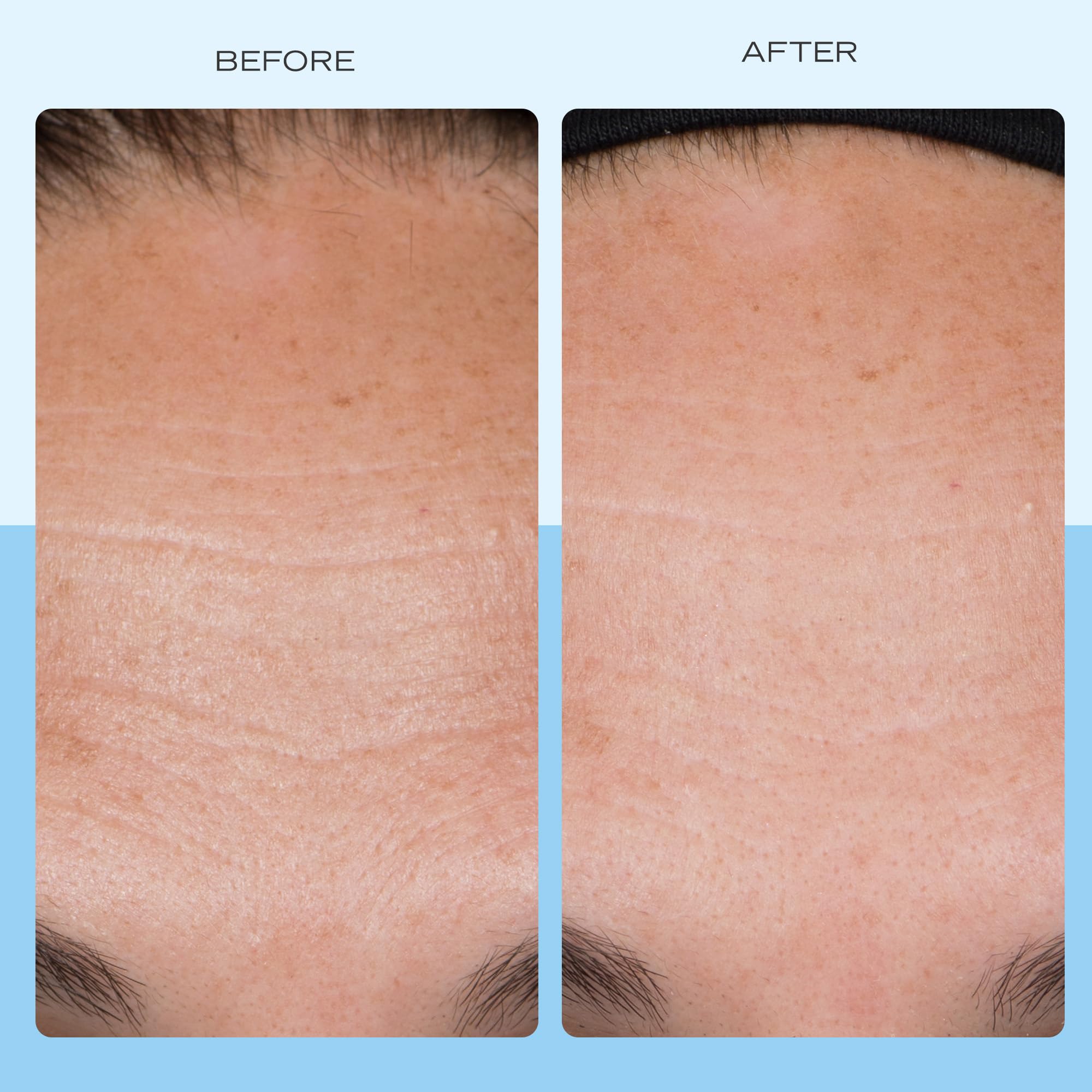 First Aid Beauty Firming Collagen Cream with Peptides & Niacinamide | Ultra-Rich, Non-Comedogenic Moisturizer