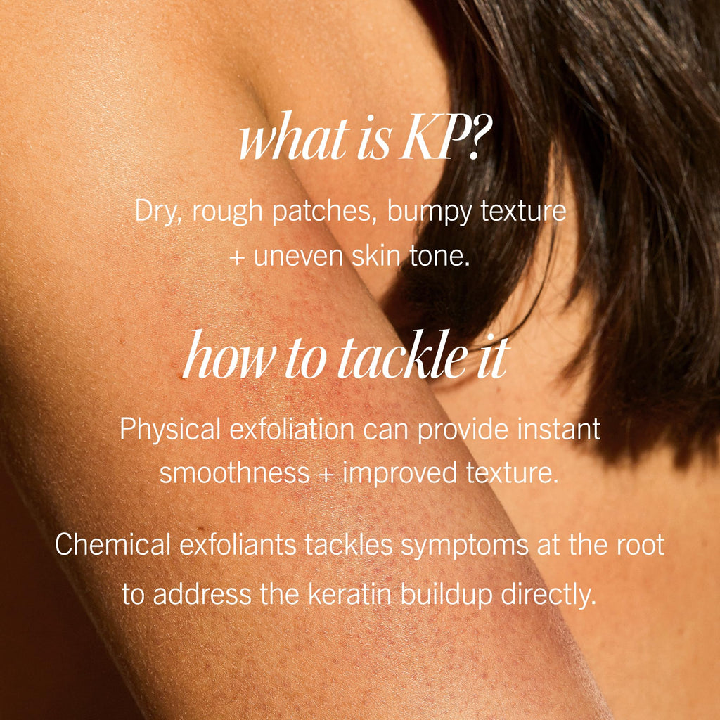 First Aid Beauty KP Bump Eraser Body Scrub — 10% AHA with Glycolic & Lactic Acids, 2 oz, 3 ct