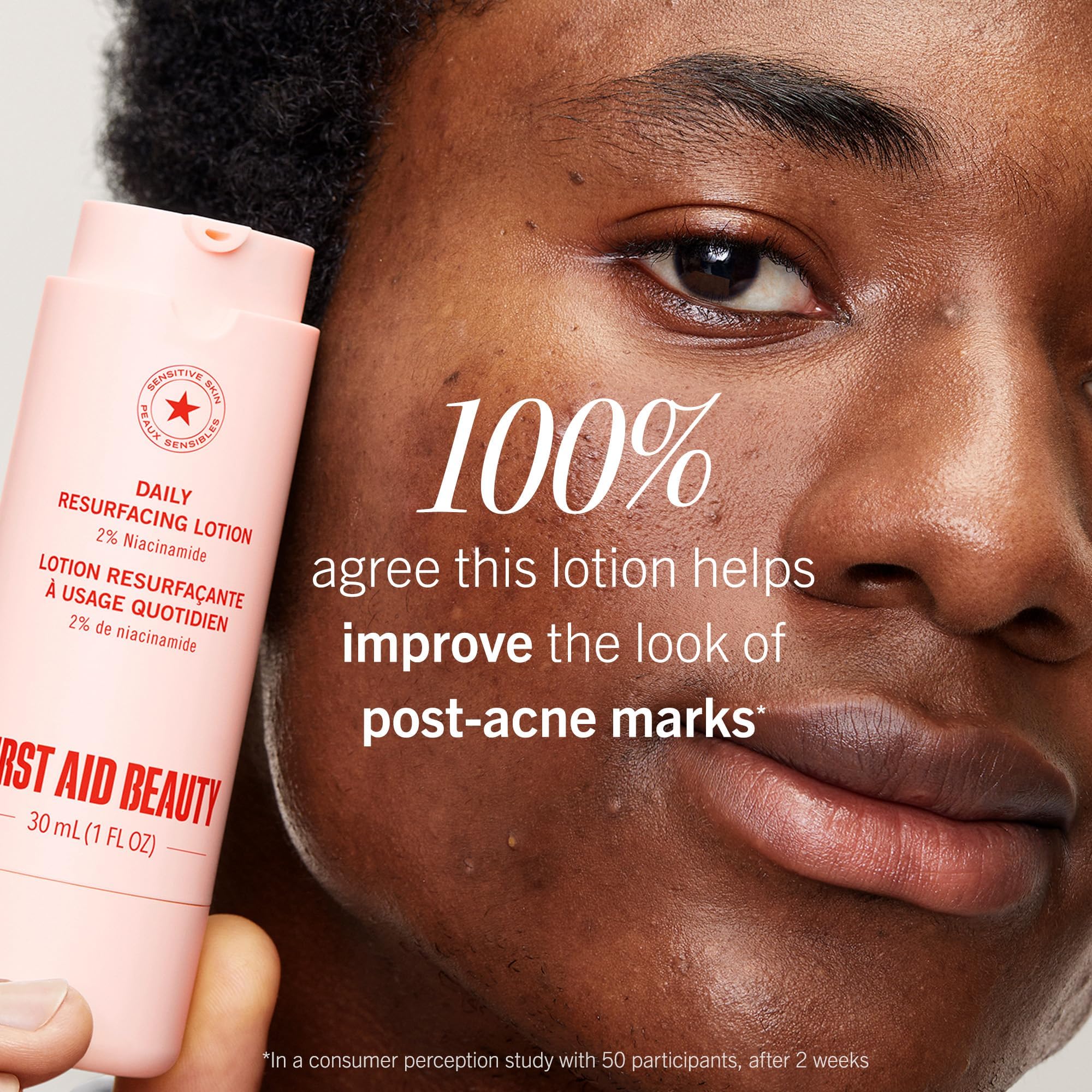 First Aid Beauty Lactic Acid Lotion with 2% Niacinamide – Resurfacing Moisturizer for Acne-Prone Skin (1 oz)