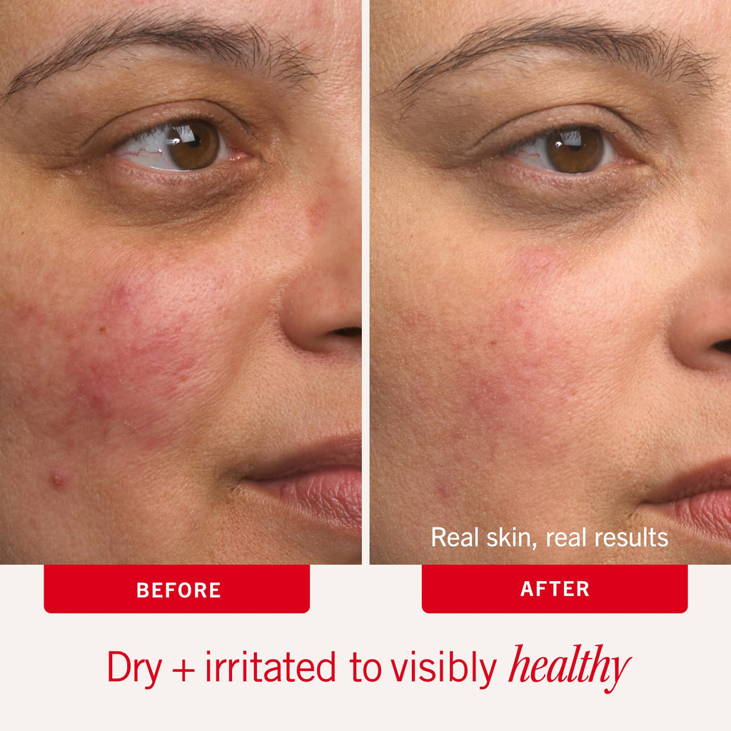 First Aid Beauty Ultra Repair Cream – Hydrating Face & Body Moisturizer, 2 oz Travel Size