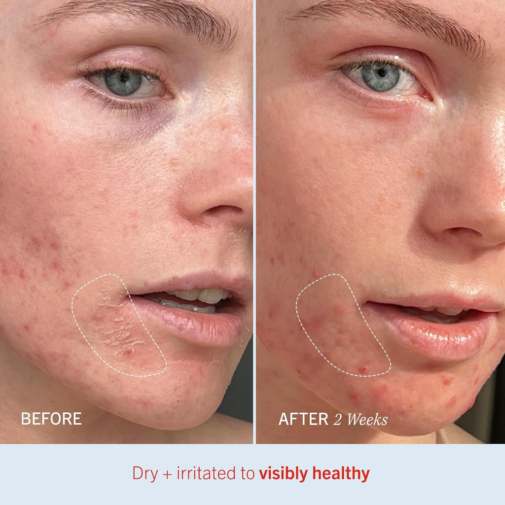 First Aid Beauty Ultra Repair Cream – 14 oz Vanilla Cinnamon | Deep Hydration