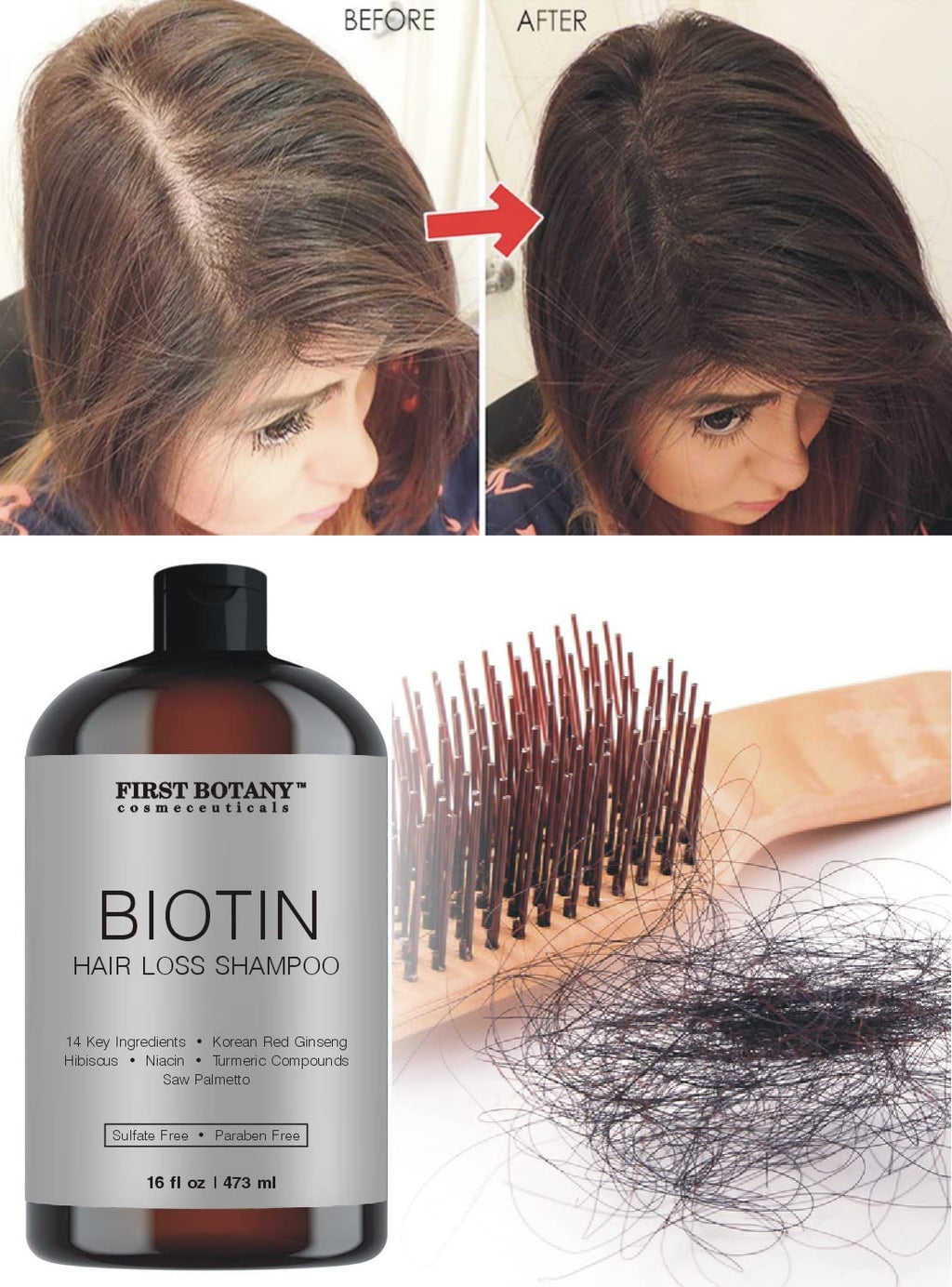 First Botany Cosmeceuticals Hair Regrowth Shampoo – DHT Blockers, Hydration & Volume (Pack of 2)