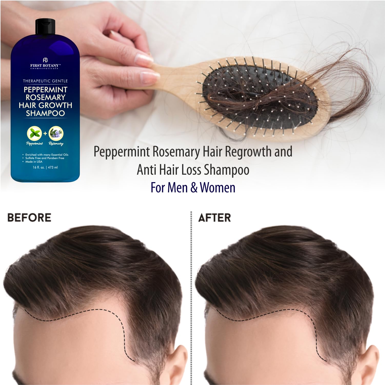 First Botany Peppermint Rosemary Hair Regrowth Shampoo – Daily Hydration & Dandruff Control, 16 oz