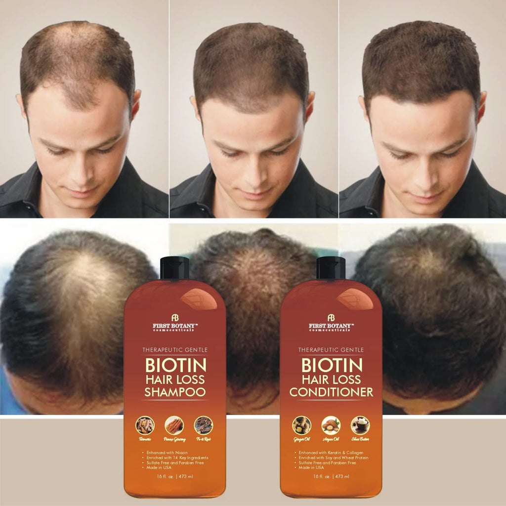 First Botany Hair Growth Shampoo & Conditioner Set – Biotin, DHT Blockers, Sulfate Free (2x16 oz)