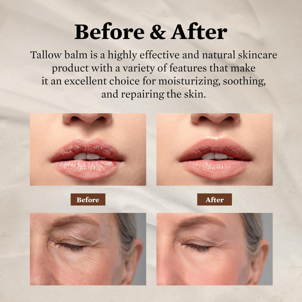 FJALLUFT Tallow Face Moisturizer for Women – Grass-Fed Beef Tallow, Manuka Honey & Olive Oil