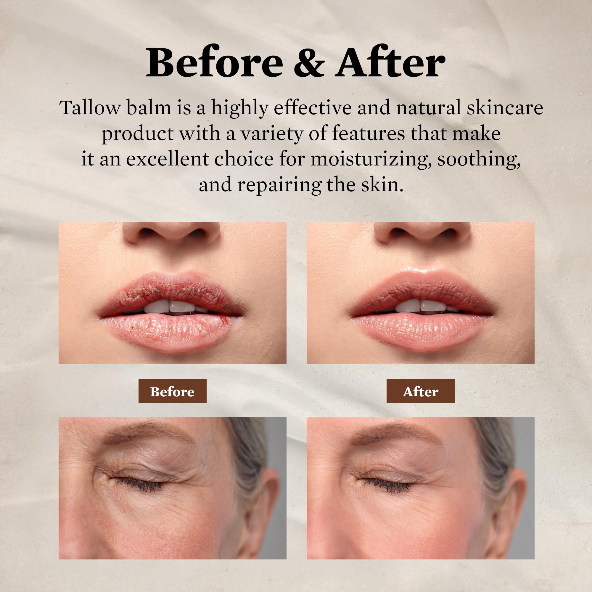 FJALLUFT Tallow Face Moisturizer for Women – Grass-Fed Beef Tallow, Manuka Honey & Olive Oil