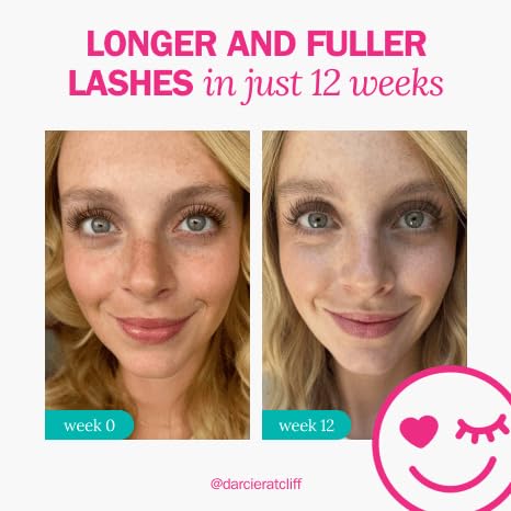FLASHSERUM fLASH Eyelash Serum – Long, Curled Natural Lashes | Safe, Doctor-Developed Formula | 2mL (3-Month Supply)