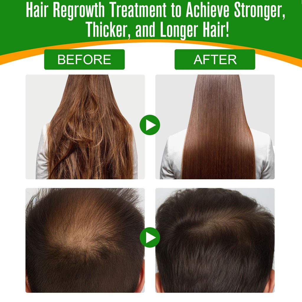 Flasture Batana Oil for Hair Growth – 100% Pure, 2.02 fl oz