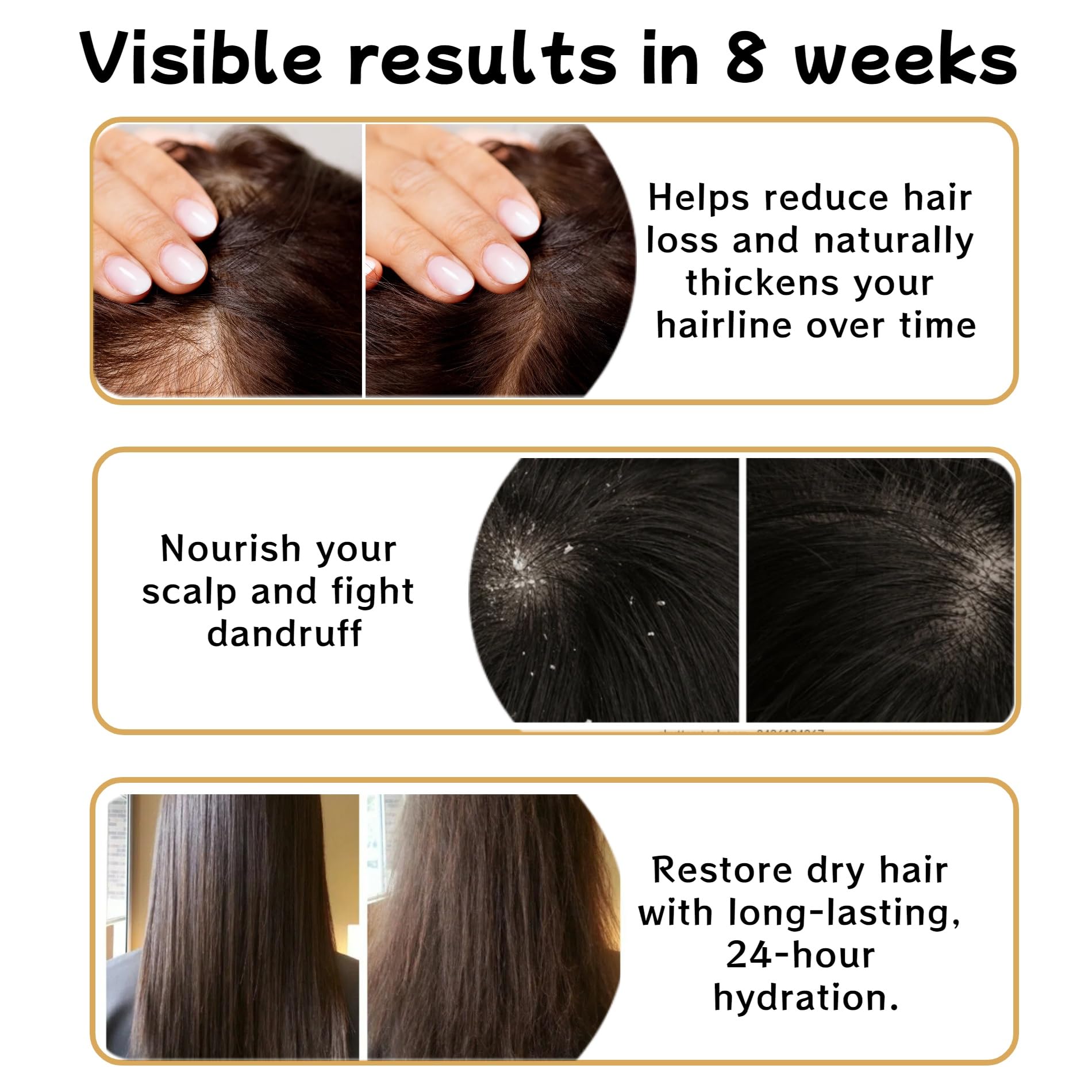 FLEXQW 2 PCS Anti Hair Loss Shampoo for Women – Hair Growth & Thickening (300ml)
