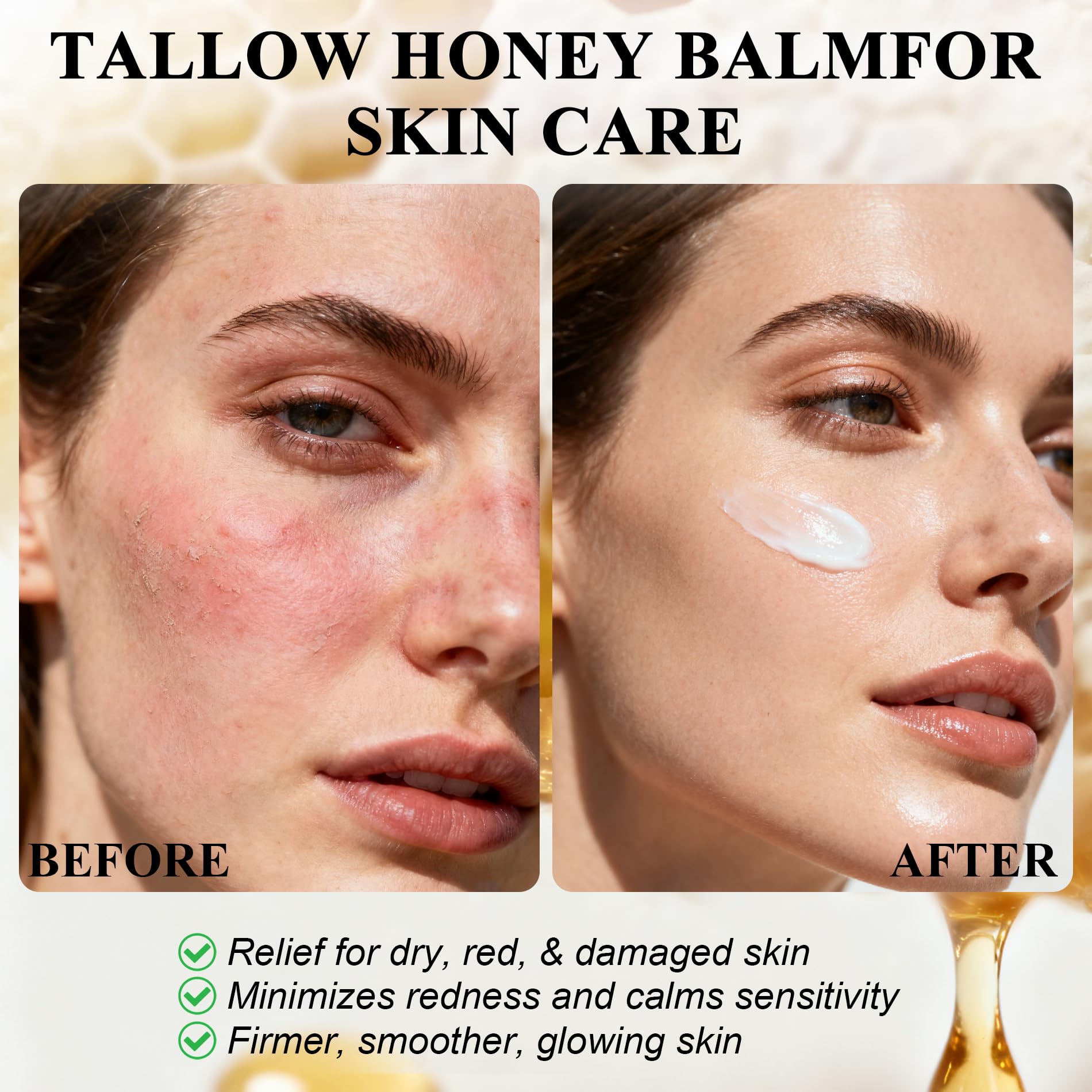 FLEXQW Bee Venom Cream – 1 Pack, 7x Moisture, Grass-Fed Tallow, All-in-One Skin Moisturizer