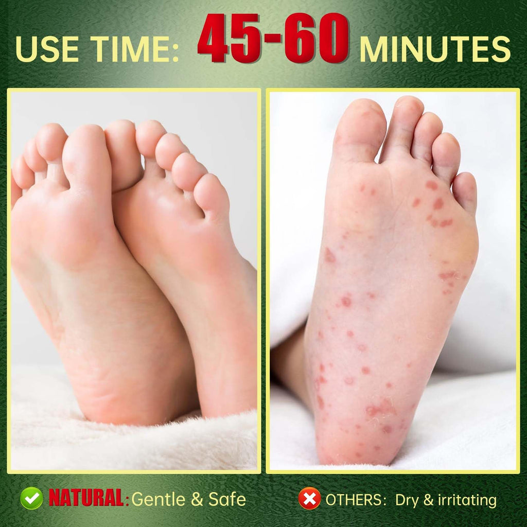FLYLEAF Foot Peeling Mask – Natural Exfoliating Foot Mask for Hydrating Heel Care (3 Pack)