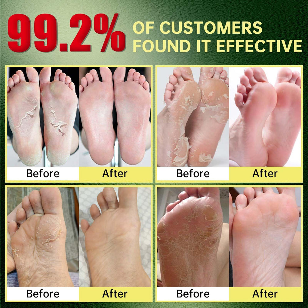 FLYLEAF Foot Peeling Mask – Natural Exfoliating Foot Mask for Hydrating Heel Care (3 Pack)