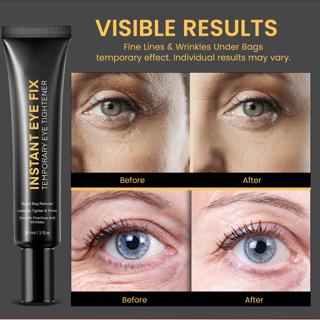 Foffreo Temporary Instant Eye Tightener Cream – Quick Under-Eye Bags, Dark Circles & Fine Lines