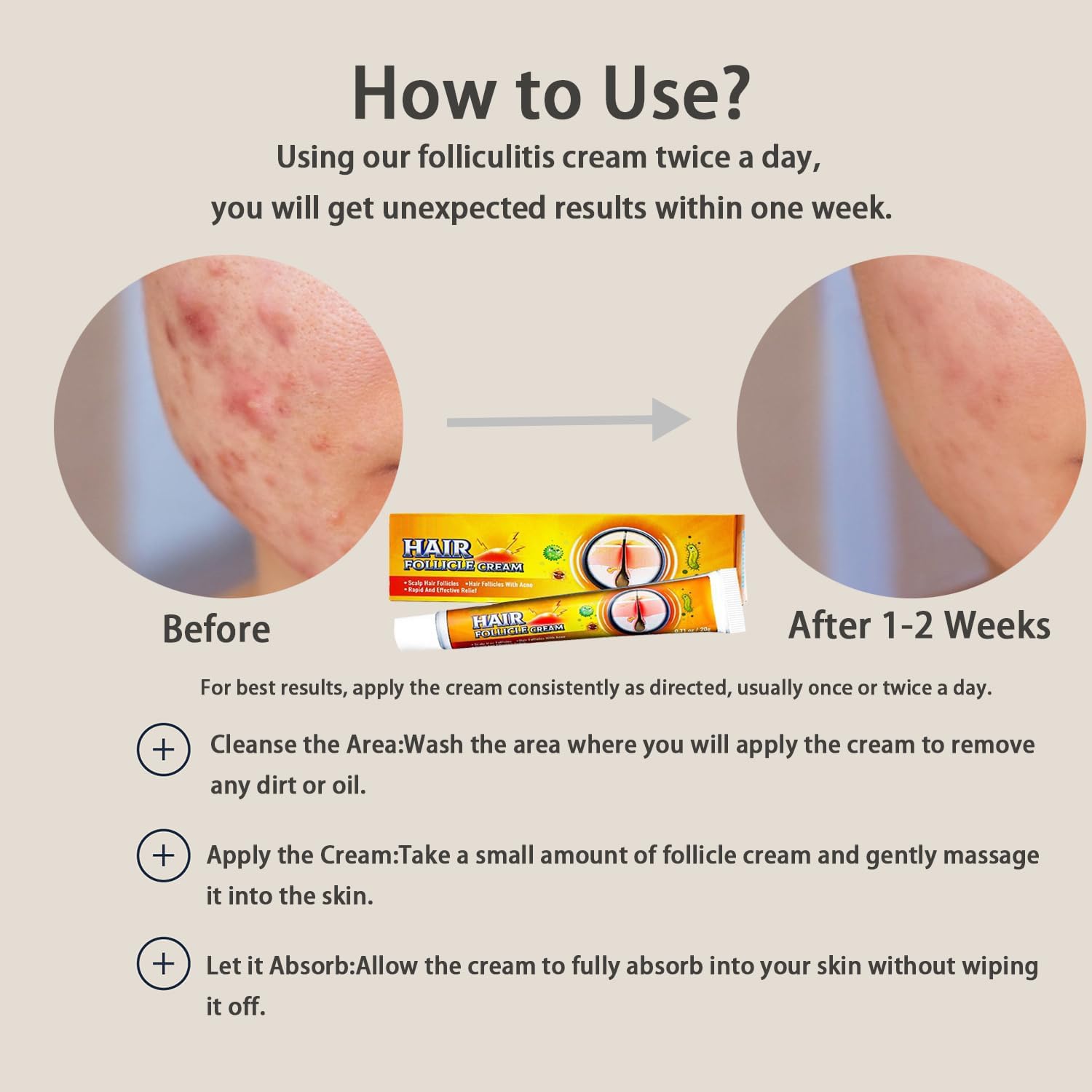 Folliculitis Cream – Effective Folliculitis Treatment for Scalp, Face & Body | 1.42 Oz