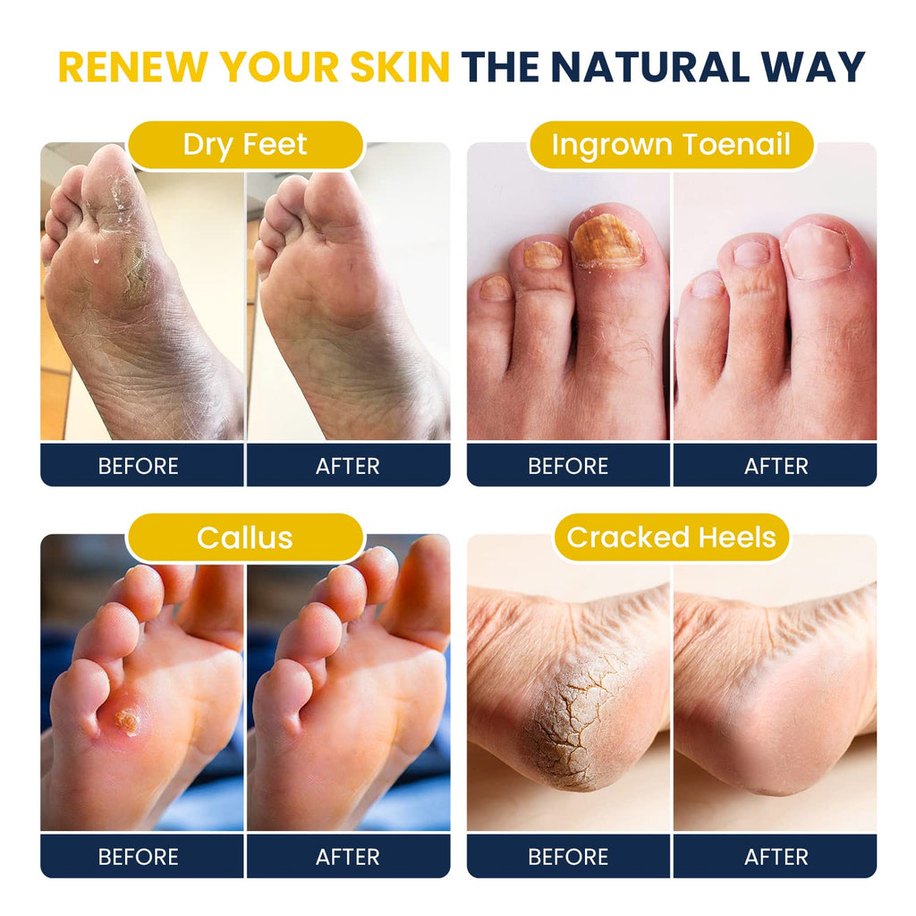 FOOT CURE Citrus Detox Foot Soak – Epsom & Dead Sea Salts (16 oz x 2)
