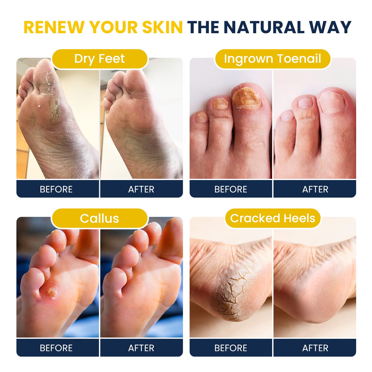 FOOT CURE Citrus Detox Foot Soak – Epsom & Dead Sea Salts (16 oz x 2)