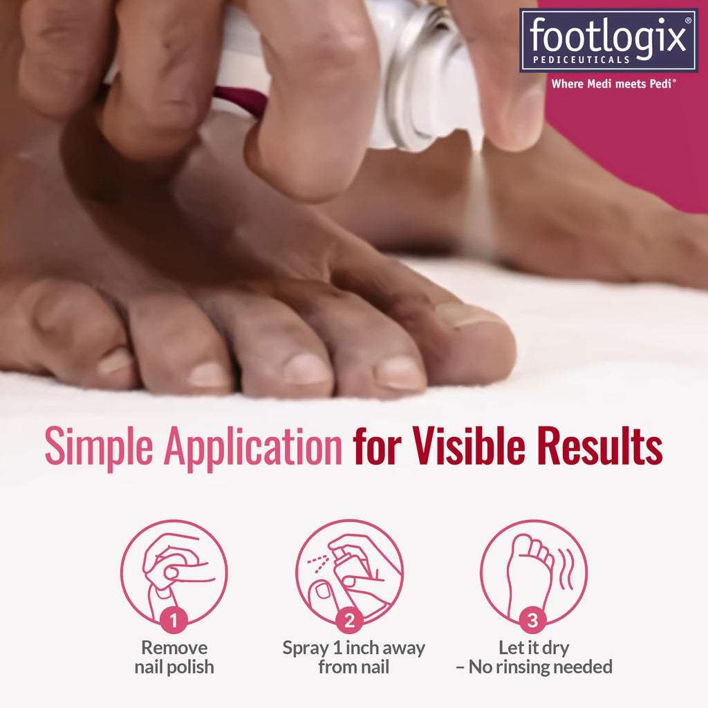 FOOTLOGIX Nail Tincture Spray with Spiraleen – 1.69 Fl Oz