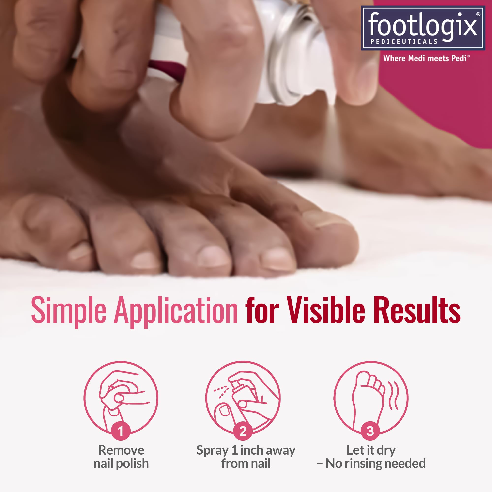 FOOTLOGIX Nail Tincture Spray with Spiraleen – 1.69 Fl Oz