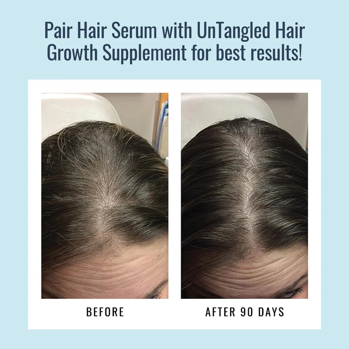 Foundation Skincare Hair Serum for Thinning Hair – Minoxidil-Free, Nourishing, 2 Fl Oz