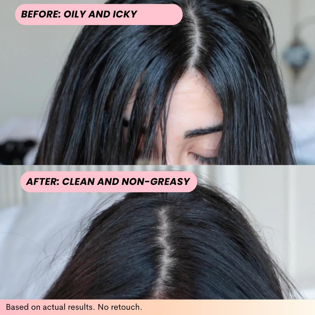 FoxyBae Volumizing Dry Shampoo with Biotin – For Dark, Brunette & Blonde Hair