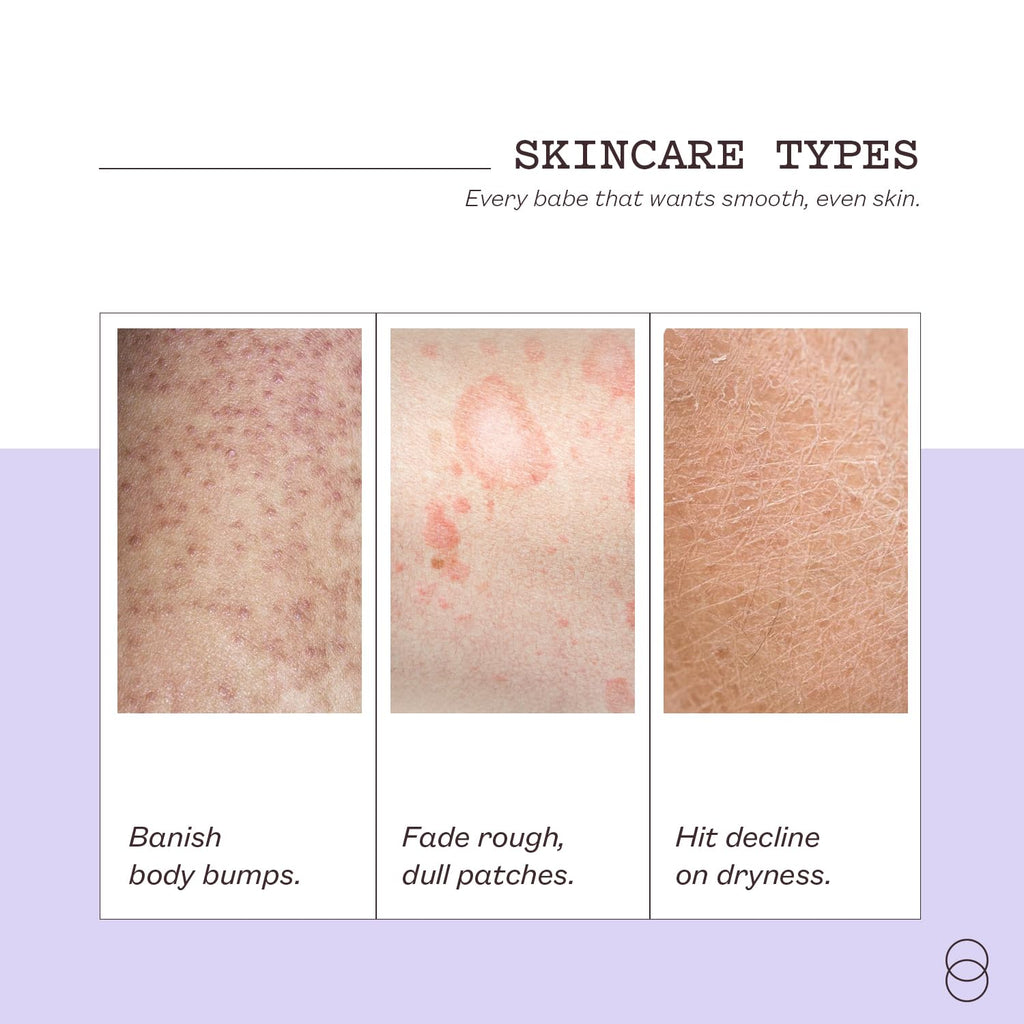 frank body Niacinamide Body Scrub – Berry Extracts & Green Tea | 250g