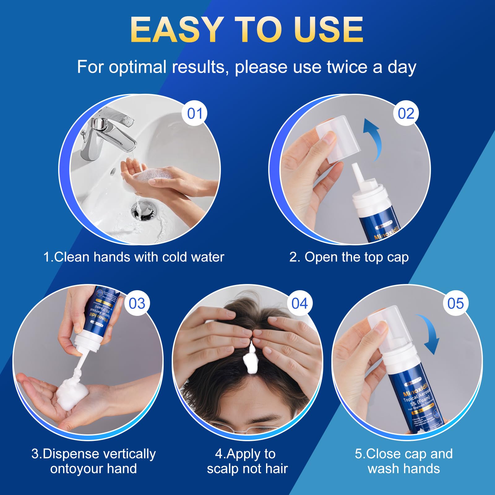 Frnoip 5% Minoxidil Foam for Men – Biotin-Enhanced Hair Regrowth