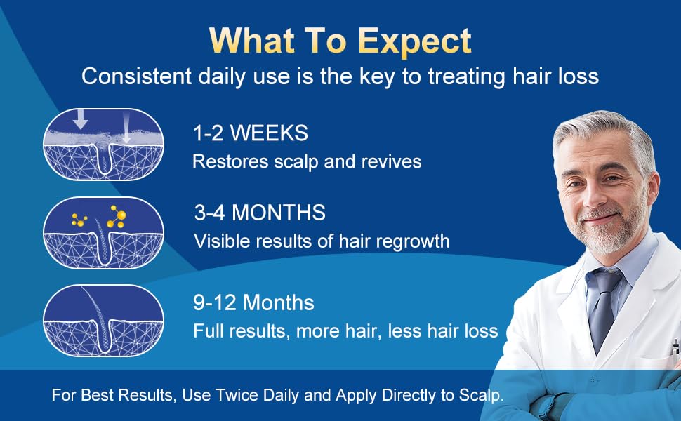 Frnoip 5% Minoxidil Foam for Men – Biotin-Enhanced Hair Regrowth