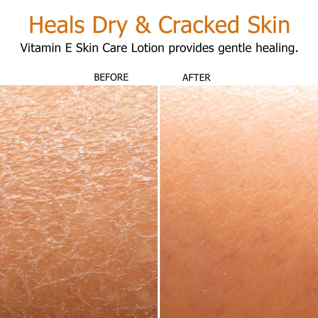 Fruit of the Earth Vitamin E Lotion 16 oz – 2 Pack | Gentle Moisturizing Lotion