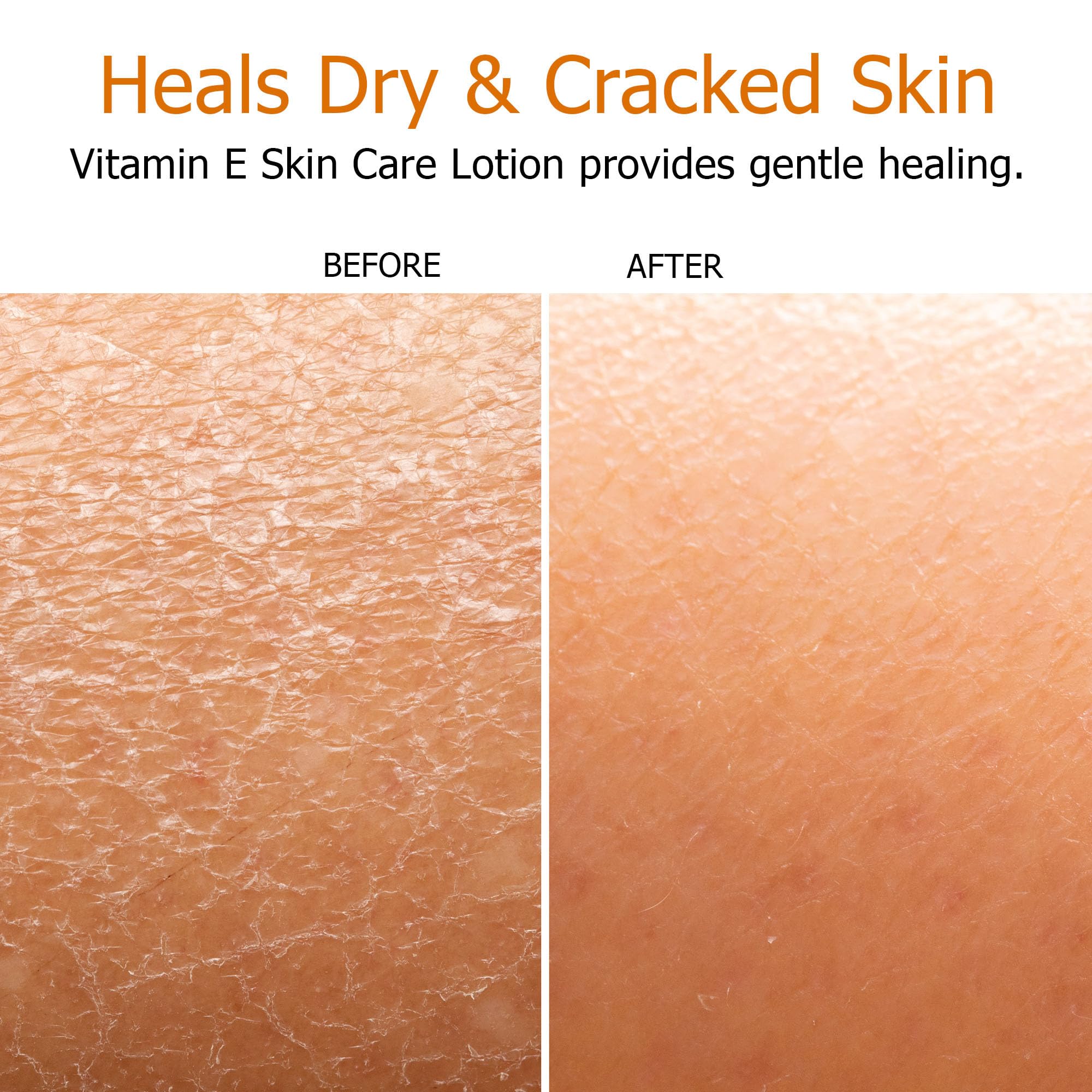 Fruit of the Earth Vitamin E Lotion 16 oz – 2 Pack | Gentle Moisturizing Lotion