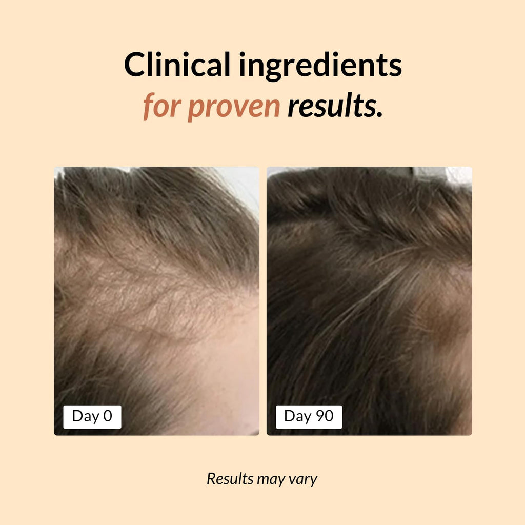 FullyVital Hair Growth Supplement for Women 35+: Thicker, Fuller Hair – Vegan & Dermatologist Recommended