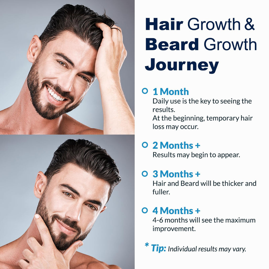 FUZYAT 5% Minoxidil Spray for Men & Women – Hair Growth Treatment (4-Pack)