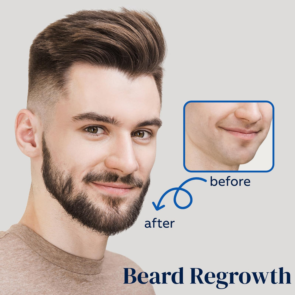 FUZYAT 5% Minoxidil Spray for Men & Women – Hair Growth Treatment (4-Pack)