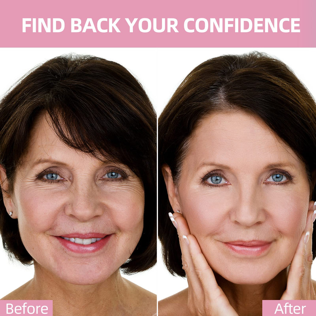GEIMIY Facial Wrinkle Patches — Overnight Smoothing for Forehead, Frown & Smile Lines (160 Pcs)