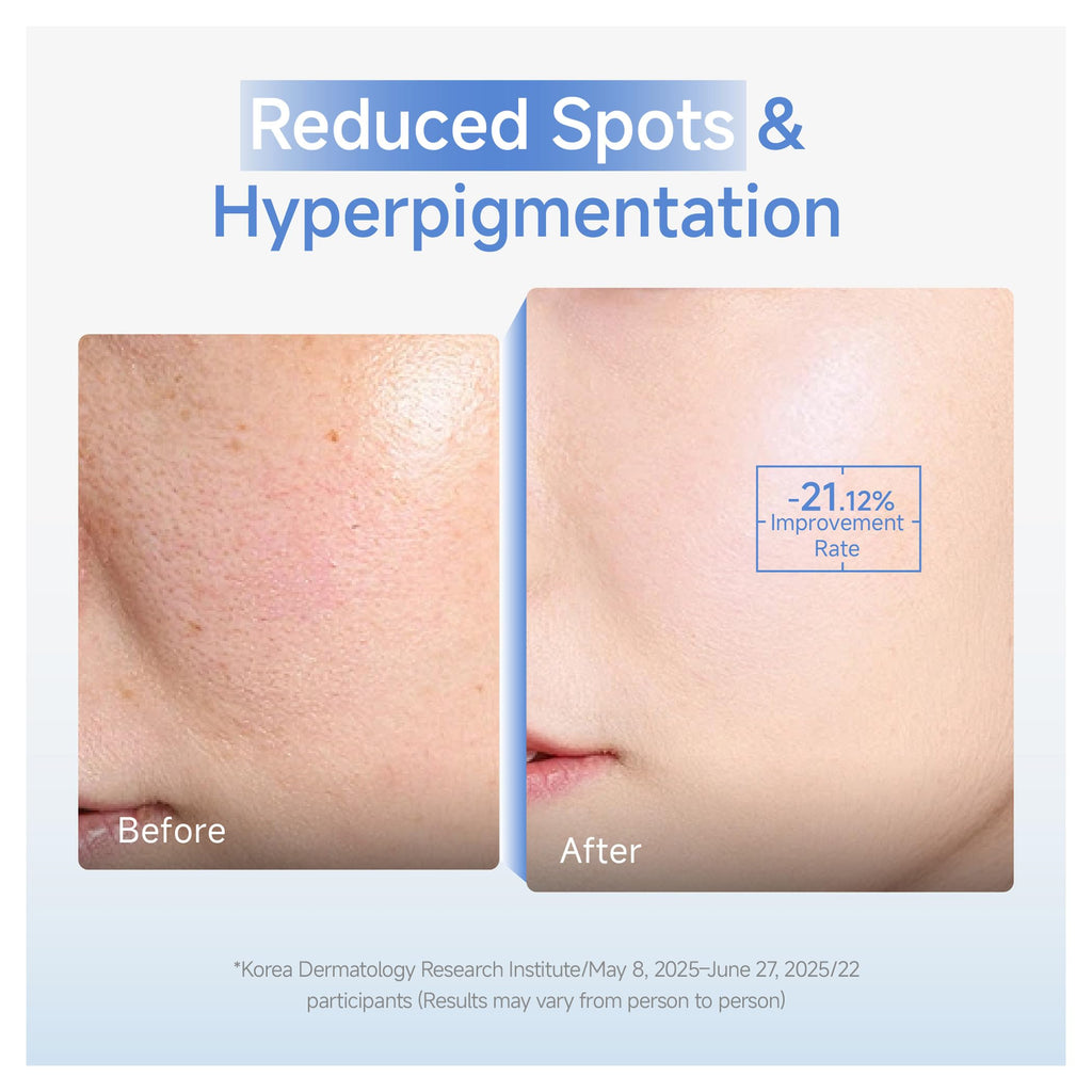 DAERA Synergy Boost Ampoule – Korean Brightening & Hydrating Serum, Dark Spot Correcting & Anti-Aging (30ml)