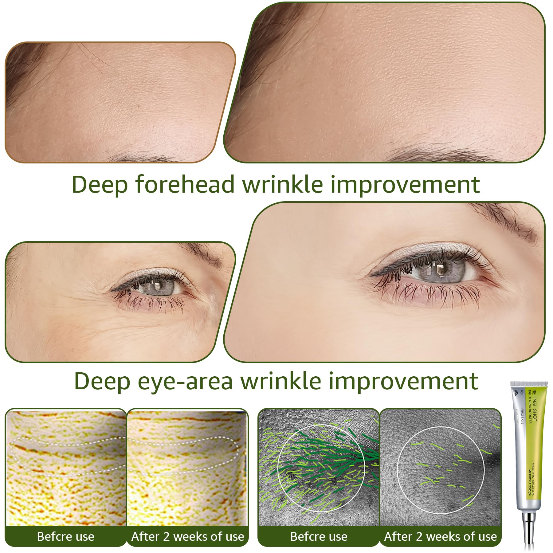 Generic Retinal Shot Tightening Booster – Pore Minimizer & Wrinkles (0.1% Retinal, Panthenol 1%)