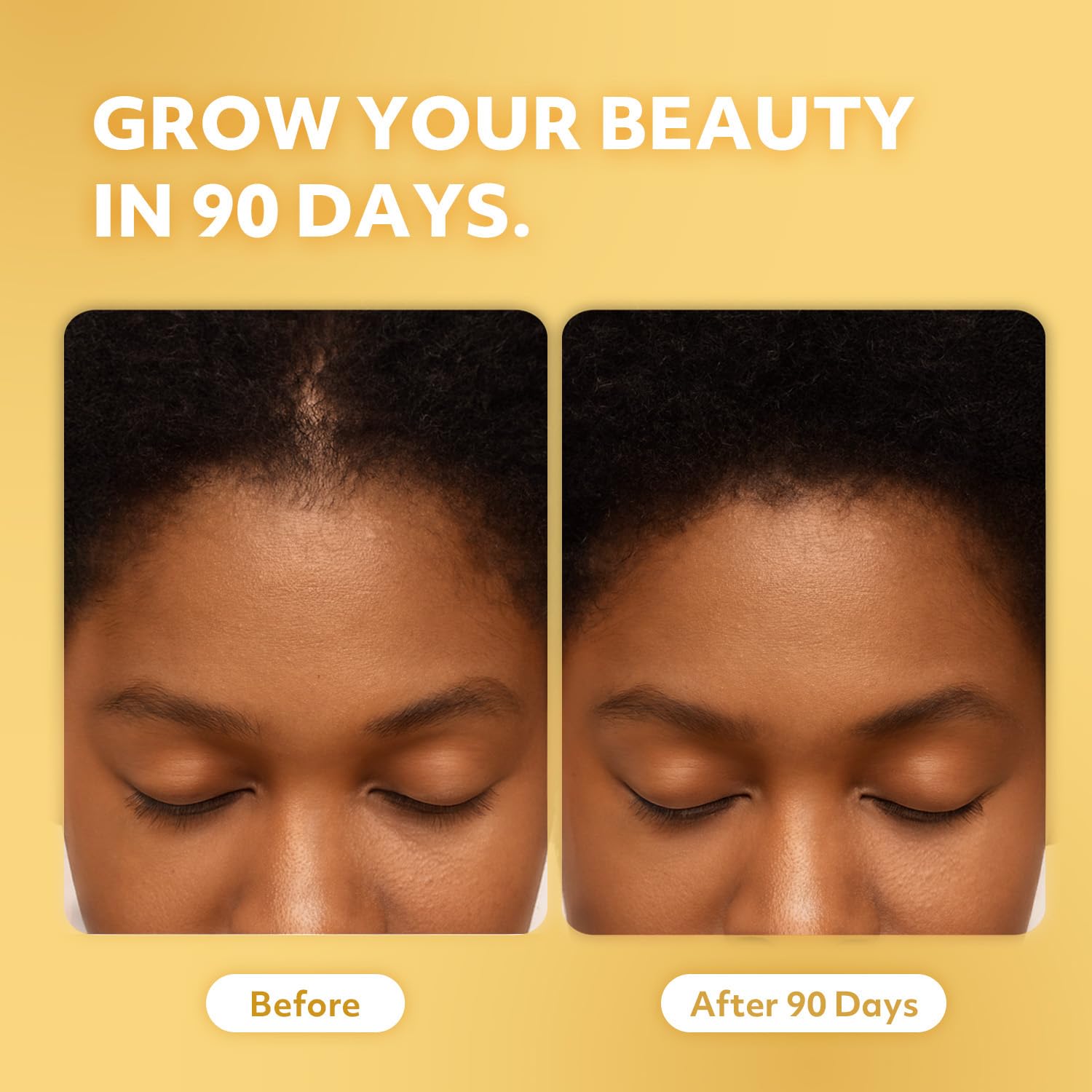 GEO BOUNTY 100% Natural Honduras Batana Oil Extra Strength – Hair Growth Support & Damaged Hair Repair | Made in USA 1.7 oz