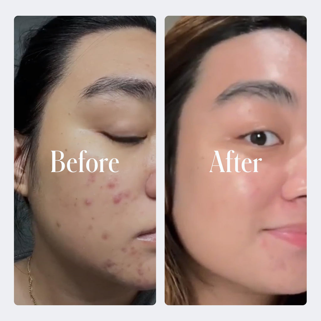 Geologie Complete Skincare Set — 3-Month Simple Daily Routine for Clear Skin