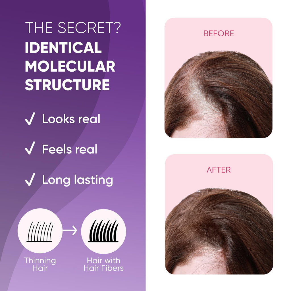 Get Back Gorgeous GBG Hair Fibers - Light Brown, 25g Bottle - Instant Coverage for Thinning Hair & Bald Spots - Cruelty Free