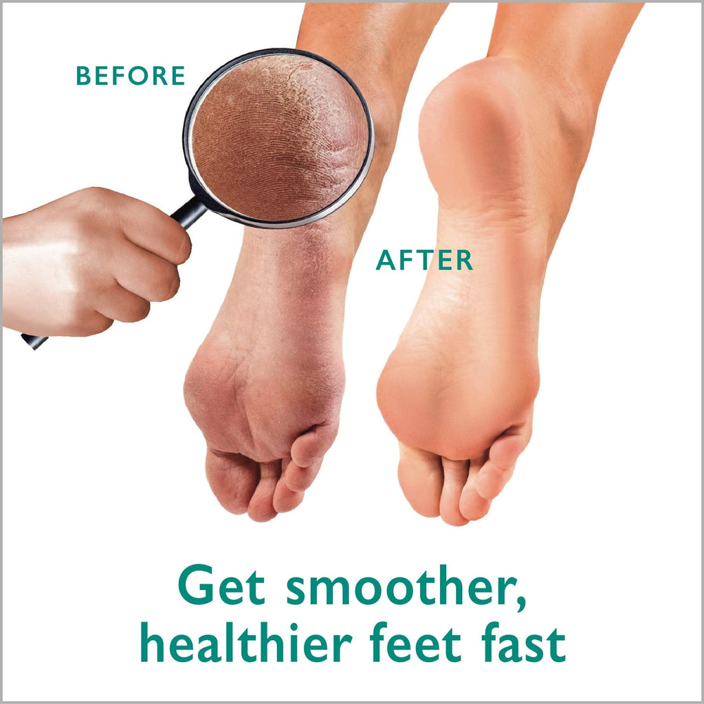 GILDEN TREE Callus Remover Gel + Foot Scrubber Kit | At-Home Pedicure Tools