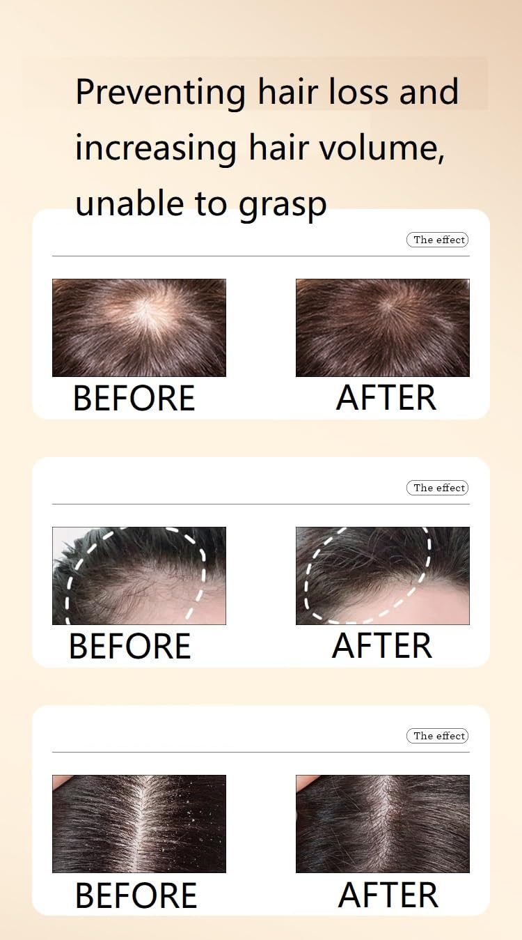 Ginaday 2 Box Ginger Plant Extract Shampoo for Hair Growth & Thinning Hair Support