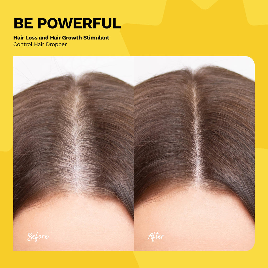 Ginger Root Extract | Growth-Stimulating Drops & Hair Loss Control | Be Powerful Serum (4 oz)